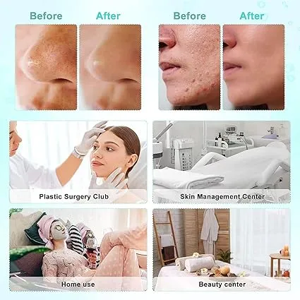 Hydra%20Facial%20Machine%20Professional%20H202%207%20in1%20-%20Image%206