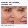 Urapra Glycolic Acid Toning Solution 7% Strength for Skin Care. 