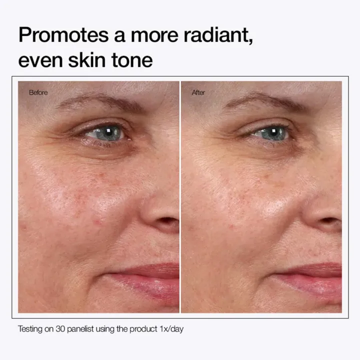Urapra%20Glycolic%20Acid%20Toning%20Solution%207%25%20Strength%20for%20Skin%20Care%20-%20Image%204