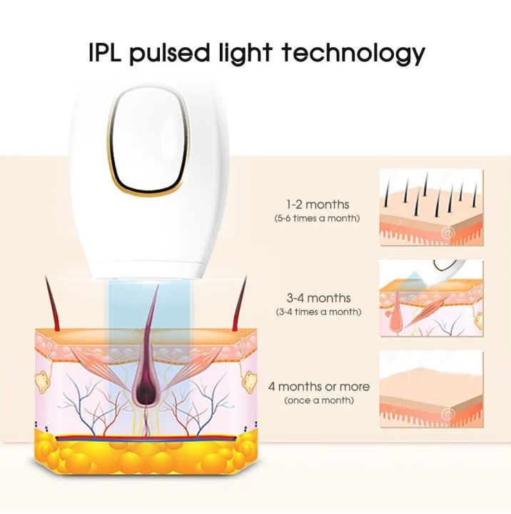 IPL%20Laser%20Hair%20Removal%20-%20Image%204