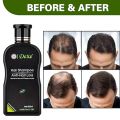 Dexe Anti Hair Loss Shampoo 200 ML Hair Growth Treatment Care For Men & Women - Herbal All Natural - Fast Acting Natural Ingredients. 