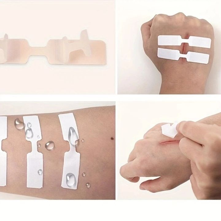 5Pcs%20Outdoor%20Wound%20Adhesive%20Tape%20Disposable%20First%20Aid%20Wound%20Suture%20Patch%20Wound%20Band%20Aid%20-%20Image%204