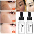 Niacinamide Dark Spot Remove Serum Anti-aging Bright Freckle Whiten Skin Cream Fade Pigmentation Melasma Moisture Face Skin Care. 