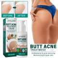 100ml Butt Acne Treatment Cream Clearing Buttock Thigh Acne Bumps Dark Spots Moisturizing Smoothing Hydrating Skin Care. 