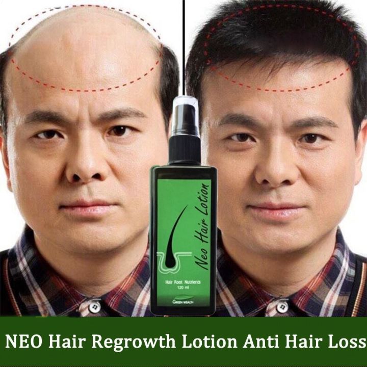 Neo%20Hair%20Lotion%20For%20Hair%20Growth%20Green%20Wealth%20-%20Image%207