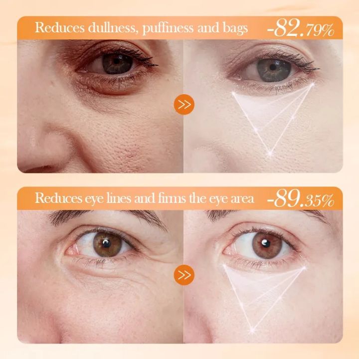 BIOAQUA%20Vitamin%20C%20Eye%20Cream%20Whitening%20Moisturizing%20Smoothing%20Repairing%20Nourishing%20Brightening%20Eye%20Cream%20Eye%20Area%20Serum%2020g%20BQY18915%20-%20Image%205