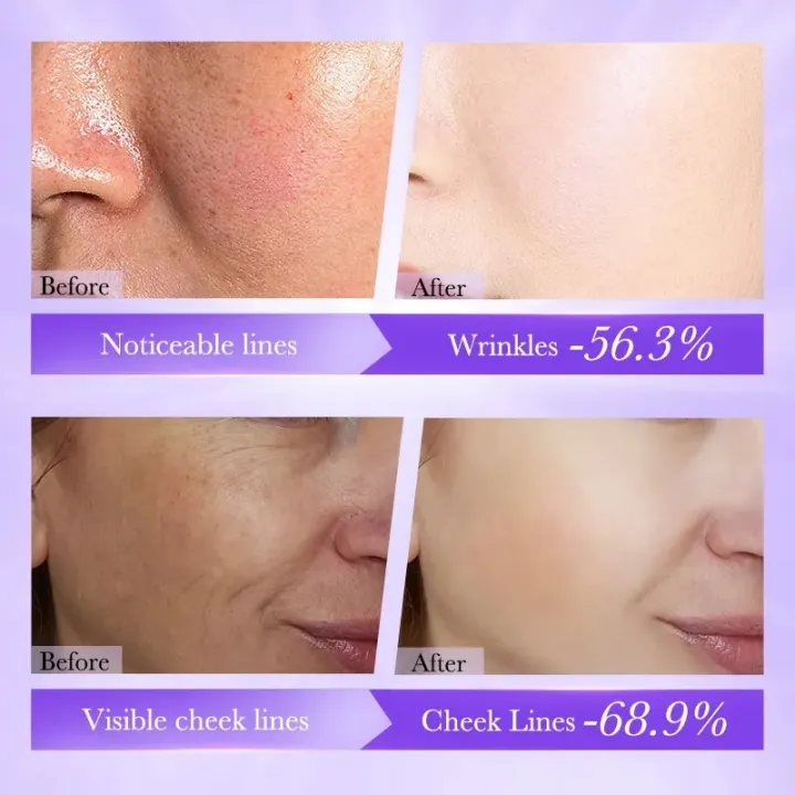 BIOAQUA%20Retinol%20Anti%20Wrinkle%20Firming%20Face%20Cream%20Whitening%20Moisturizing%20Brightening%20Cream%2060g%20BQY18809%20-%20Image%207