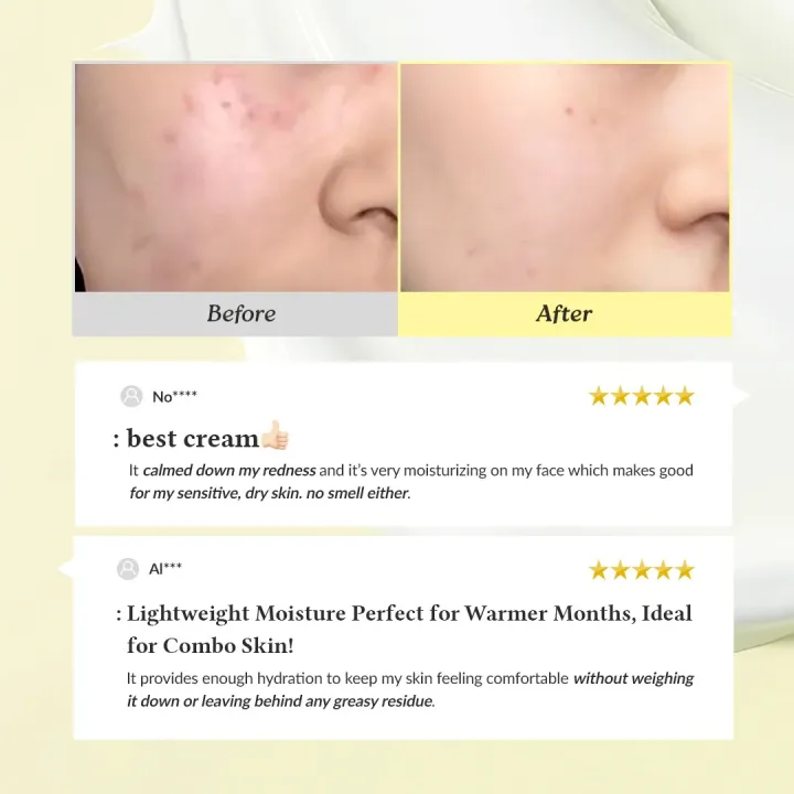 Dr%20Althea%20345%20Relief%20Cream%20Daily%20Soothing%20Moisturizer%20for%20Blemish-Prone%20Skin%20%7C%20Niacinamide%20+%20Panthenol%20%7C%20Korean%20Skincare%20%E2%80%93%2050ml%20-%20Image%203