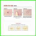 24pcs Face Acne Pimple Spot Facial Skin Care Blackhead Removal Freckle Patches Scar Care Treatment Stickers Acne Mask Beauty. 