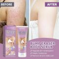 Repair Chicken Skin Cream Keratosis Pilaris Cream For Strawberry Legs Removal Dark Spot Bump Eraser Body Scrub Smooth Lotion. 