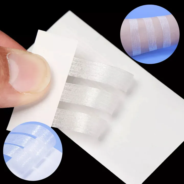 %E3%80%90HOT%E3%80%91%201%20Set%205%20Sizes%20Seam-Free%20Medical%20Tape%20Surgery%20Postpartum%20Skin%20Wound%20Strip%20Pull-On%20Tight%20Anti-Speed%20First%20Aid%20Safety%20Beauty%20Tapes%20-%20Image%202