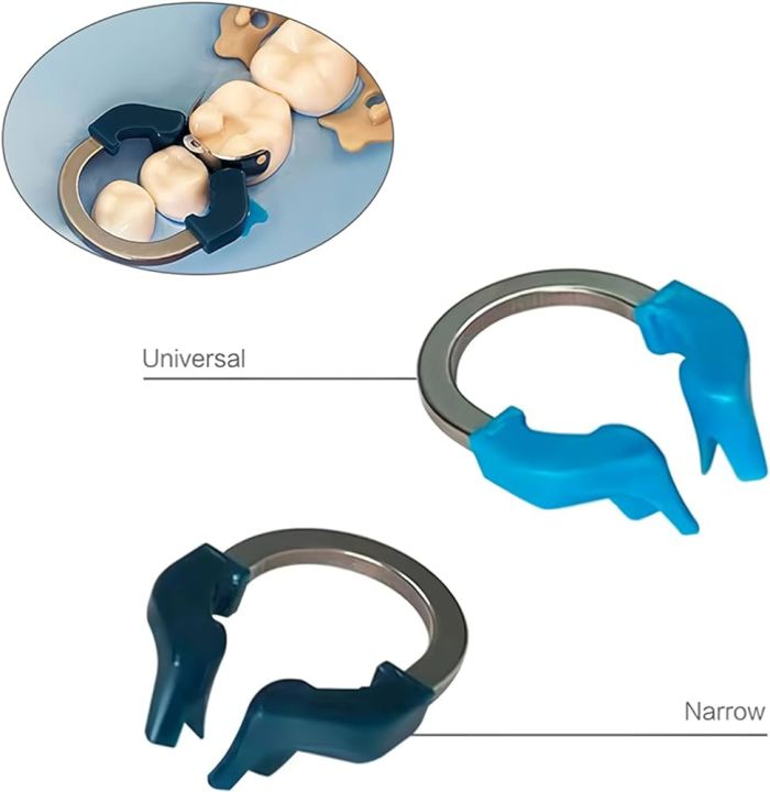 Dental%20Matrix%20Narrow%20Ring,%20Dental%20Sectional%20Contoured%20Matrix%20Narrow%20Bands%20Nickel%20Titanium%20Clamping%20Narrow%20Clip%20Ring%20Dental%20Separation%20Ring%20Dentist%20Tools%20-%20Image%202