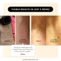 NEW Flasher 2.0 by Nood, IPL Laser Hair Removal Device for Men and Women, Pain-free and Permanent Results, Safe for Whole Body Treatment - Gloss White. 