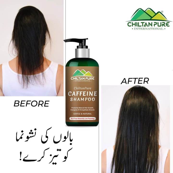 Chiltanpure%20Caffeine%20Shampoo%20revitalizes%20dry,%20dull,%20and%20brittle%20hair%20by%20deep%20cleansing%20-%20Image%202