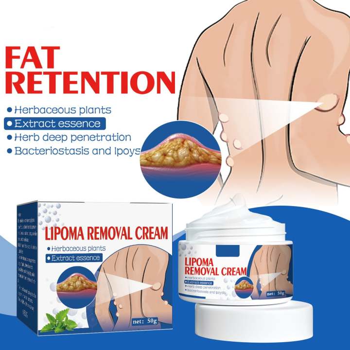 Lipoma%20Removal%20Cream%20%7C%20Advanced%20Lipoma%20Treatment%20Cream%20%7C%20Safe%20&%20Gentle%20Use%20-%20Image%202