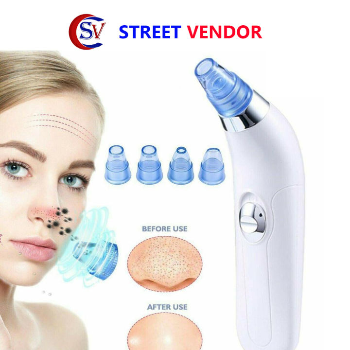 STREET%20VENDOR%20Blackhead%20Removal%20Machine%20Derma%20Suction%204%20in%201%20Black%20Head%20Remover%20Machine%20-%20Acne%20Pore%20Cleaner%20Vacuum%20Suction%20Tool%20Blackhead%20Removal%20On%20Nose%20Sucking%20Machine%20-%20Image%203