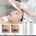 Black Head Remover Machine - Deep Face Cleanser & Pores Cleaner - Blackhead Removal Machine - Pimple Remover - Blackhead Remover - Face Cleaner Machine - Skin Scrubber for Whiteheads, Acne, and Wrinkles - Ultrasonic Face Cleaning & Lifting Device. 