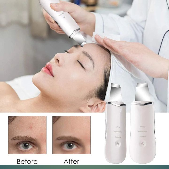 Black%20Head%20Remover%20Machine%20-%20Deep%20Face%20Cleanser%20&%20Pores%20Cleaner%20-%20Blackhead%20Removal%20Machine%20-%20Pimple%20Remover%20-%20Blackhead%20Remover%20-%20Face%20Cleaner%20Machine%20-%20Skin%20Scrubber%20for%20Whiteheads,%20Acne,%20and%20Wrinkles%20-%20Ultrasonic%20Face%20Cleaning%20&%20Lifting%20Device%20-%20Image%207