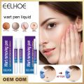 EELHOE Skin Tag Remover Eliminate Warts Remover Cream Body Mole Wart Remover Corn Plaster Filiform Flat Warts 5ml Free Shipping. 