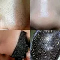 10pcs Nose Blackhead Remover Strips Mask Skin Care Shrink Pore Acne Treatment Mask Deep Nose Pore Cleansing Strips Black Head Remover. 