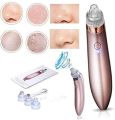 USB Rechargeable Derma Suction 4 in 1 Four Different Levels Suction Blackhead Whitehead Extractor Remover Device Acne Pimple Pore Cleaner... 