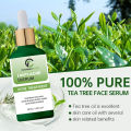 CHARMINGFLOW Anti Acne serum with Salicylic Acid for oil Control and acne removal 30 ml. 