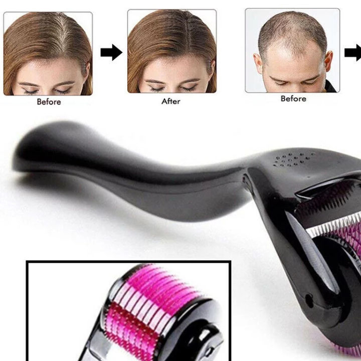 Derma%20Roller%20540%20Titanium%20Micro%20Needles%20for%20Beard%20Growth%20and%20Hair%20Loss%20Treatment%200.5mm%20-%20Image%202