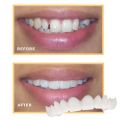 Snap-On Teeth Veneers for Upper & Lower | Comfortable Silicone Denture Covers | Instant Smile Braces. 
