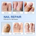 1 SOLUTION SHOP Nail Fungal Treatment Patch | Anti Fungus Toe Nail Repair Strips | Overnight Hydrogel Patch for Yellow Nails, Cracked & Brittle Nail Care | Fast Nail Restoration | 21 Patches | Anti Infection Nail Protector for Healthy Shiny Toenails. 