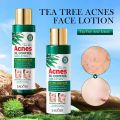 Sadoer Acnes Tea Tree Anti Wrinkle Oil Control Moisturizing & Nourishing Face Lotion 120ml. 