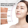 RtopR Hyaluronic Acid Collagen Face Serum Anti Wrinkle Skin Care Essence Face Care Whitening Anti-Aging Facial Serum 20ml. 