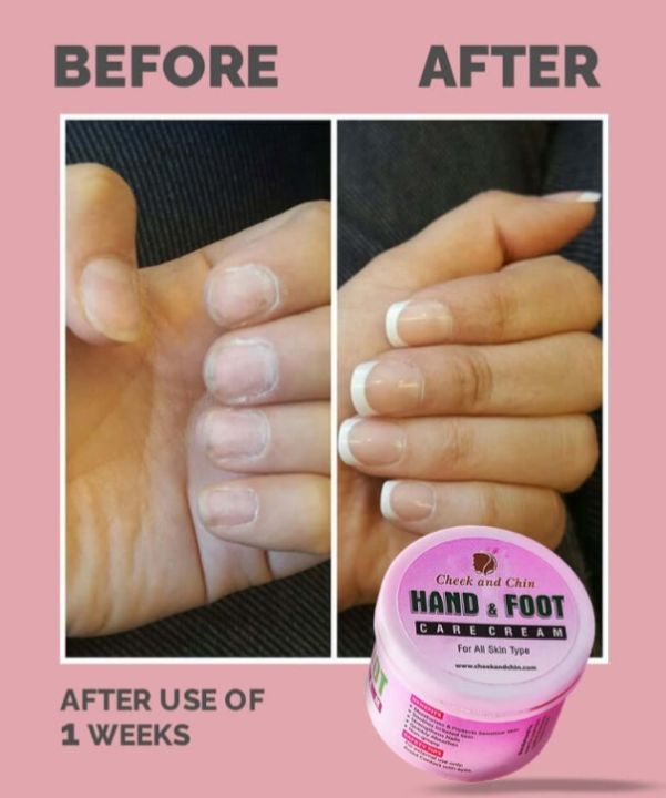 Hand%20and%20Foot%20Cream%20for%20Whitening%20&%20Glowing:%20Nourishing%20and%20Brightening%20Care%20for%20Softer,%20Brighter%20Skin%20-%20Image%203