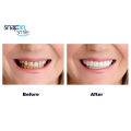 Pack Of 2 Pairs Snap-On Smile Custom Fit Perfect Smile Veneers In 3 Easy Steps. 