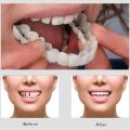Snap On Smile Veneers Teeth For Men And Women Moldable False Artificial Braces Teeth Kits Snap On Smile - Veneers Teeth for Men and Women Instant Smile Veneer Silicone Fake Teeth Cover  1 Pair Snap on Teeth Veneers for Men and Women. 