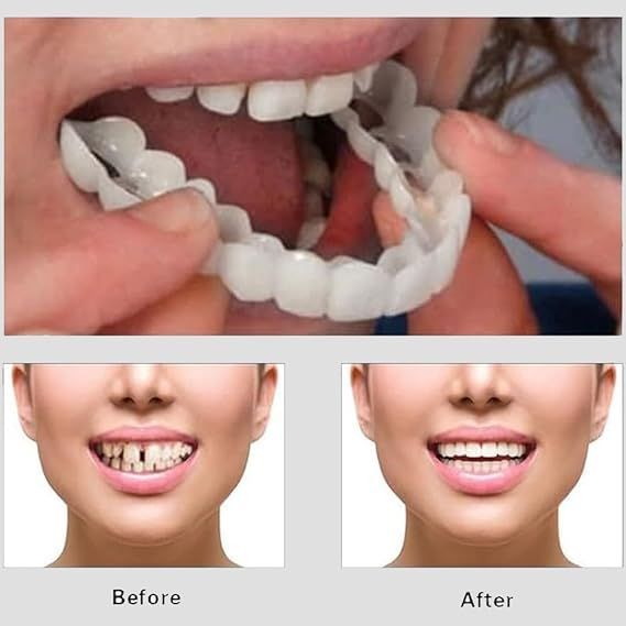 Snap On Smile Teeth Veneers Upper & Lower | Invisible Smile Teeth Cover for Men & Women | Silicone Fake Teeth for Gaps, Overbite | Instant Smile Teeth Whitening Cap
