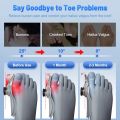 Adjuster Bunion Corrector Foot Posture Corrector Foot Relief Hallux Valgus Toe Correction Pedicure Feet Bone Thumb Foot Massager. 
