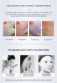 Facial Mesotherapy Electroporation RF EMS Radio Frequency Photon Face Lifting Tighten Wrinkle Removal Face Skin Care Tool 1pcs. 