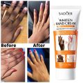 Sadoer Dark Knuckles Fast Whitening Anti Cracking Cream Niacinamide Vitamin C Whaitening Hand Cream SD04130. 