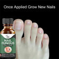 Nail Fungus - Nail Fungus Treatment  - Nail Repair - Nail Infection - Finger Nail Treatment - Fungus Remover- Fungus Treatment - 10ml - Zumer Trade. 