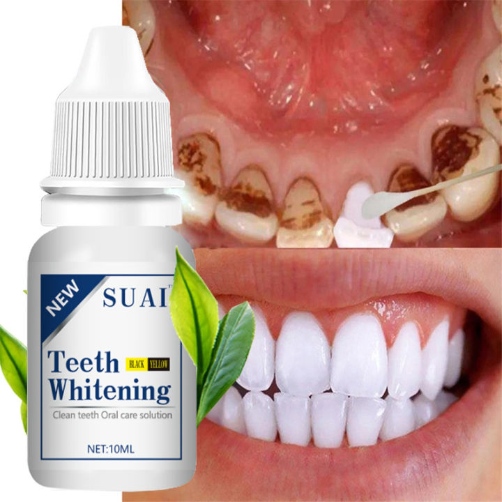 10ML%20Teeth%20Whitening%20Toothpaste%20Dental%20Oral%20Hygiene%20Remove%20Stains%20Plaque%20Teeth%20Cleaning%20Tooth%20Tool%20-%20Image%203