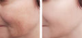 GlutaMax Skin Brightening Cream With Glutathione Reveals Beautiful And Perfect White Skin. 