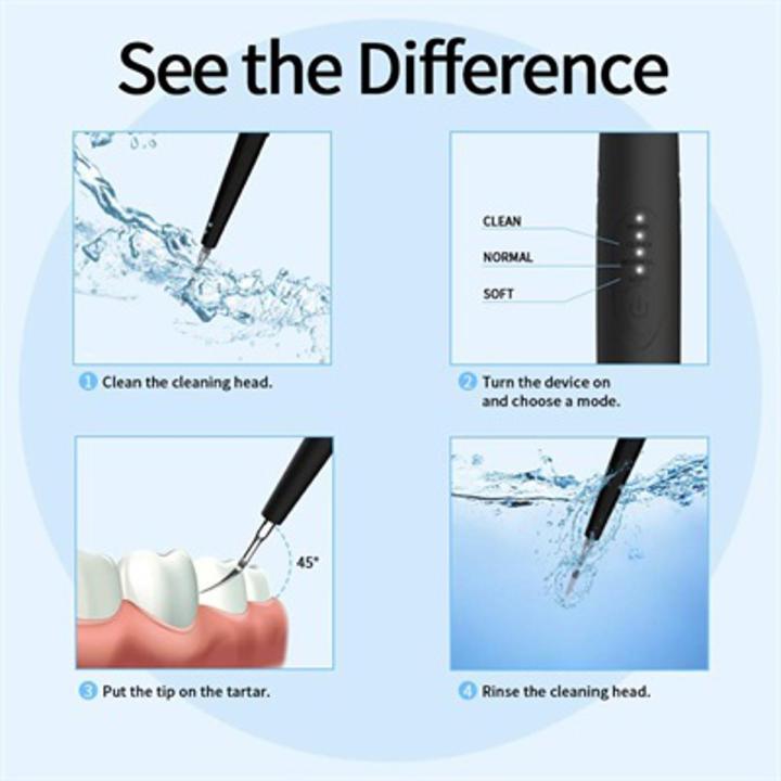 IFANZE DENTAL CALCULUS REMOVER PORTABLE ELECTRIC TARTAR SCRAPER PLAQUE REMOVER