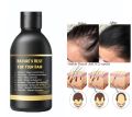 8in1 Herbal Hair Oil with Almond, Aloe Vera, Olive, Amla, Mustard, Black Seed, Onion & Coconut Oil - Powerful Hair Treatment for Anti Hair Fall, Anti Dandruff, Hair Growth & Nourishment - Essential for Shiny & Healthy Hair Care, 100ML/60ML PROMISE TO SELL. 
