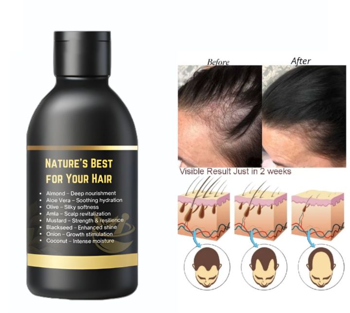 8in1%20Herbal%20Hair%20Oil%20%7C%208%20in%201%20Natural%20Hair%20Oil%20with%20Almond,%20Aloe%20Vera,%20Olive,%20Amla,%20Mustard,%20Black%20Seed,%20Onion%20&%20Coconut%20Oil%20%E2%80%93%20Hair%20Growth%20Oil,%20Anti%20Hair%20Fall,%20Anti%20Dandruff,%20Nourishing%20Treatment%20for%20Strong,%20Long,%20Shiny%20&%20Healthy%20Hair%20%E2%80%93%20100ML/60ML%20-%20Image%204