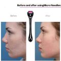 Derma Roller 0.5 With 540 Micro Needle, Wrinkles, Acne Scar Removal. 