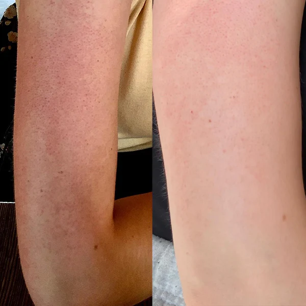 Metafil%20Moisturising%20Lotion%20%7C%20150ml%20-%20Image%203