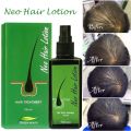 Neo Hair Lotion For Hair Growth Green Wealth. 