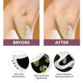 Lymphatic Treatment Lymph Nodes Neck Armpit Detox Pads Boost Metabolism Lymphatic Detox Stickers for Swelling Lymphatic Drainage. 