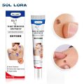 SOL LORA Cross-Border Amazon AliExpress Wart-Removing Cream Wart-Removing Flat Wart-Removing Silk Wart Cream Corns Mole Remover Cream. 