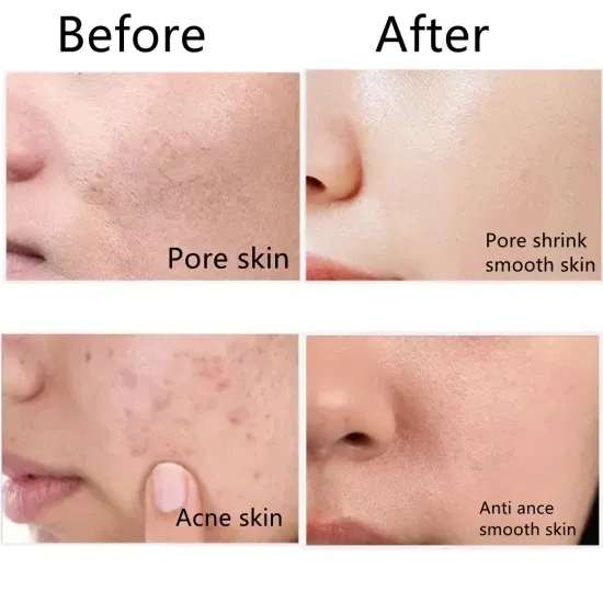 Dermatologist%20Tested%20Best%20Selling%20Foaming%20Face%20Wash%20For%20Clear%20Skin%20-%20Suitable%20for%20All%20Skin%20Types%20100%20ml%20%20-%20This%20Will%20Change%20Your%20Life:%20Say%20Hello%20to%20Glow%20with%20Our%20Best%20Selling%20Face%20Wash!%20%E2%98%85%E2%98%85%E2%98%85%E2%98%85%E2%98%85%20-%20Image%204